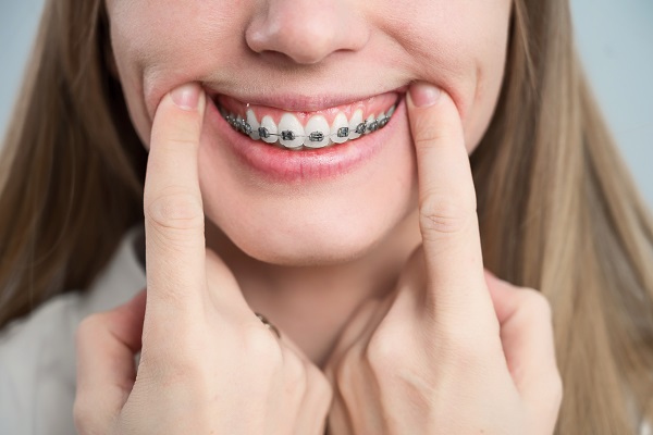 Ask An Orthodontist &#    ; How Can A Braces Specialist Address Complex Issues?