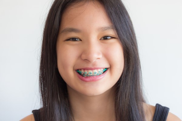How A Braces Specialist Can Enhance Your Smile