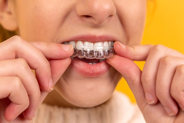 FAQs About Teeth Straightening With Invisalign®